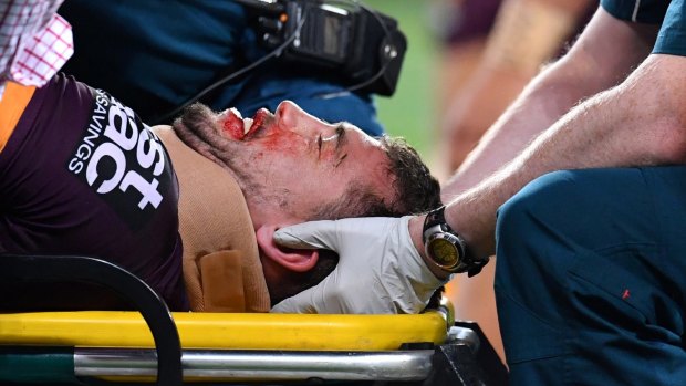 Knock out: Corey Oates leaves the field on a stretcher on Friday night.