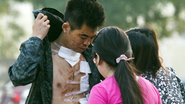 An injured man walks out of a hospital catering to victims of the explosion on Thursday morning.