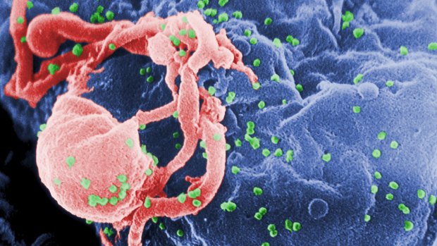 A scanning electron micrograph of multiple round bumps of the HIV-1 virus on a cell surface.