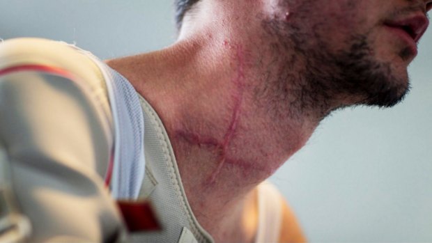 Girdlestone's neck injuries.
