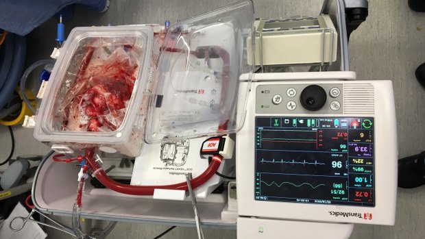 Breagha's new heart in the ex vivo perfusion rig or heart-in-a-box. 