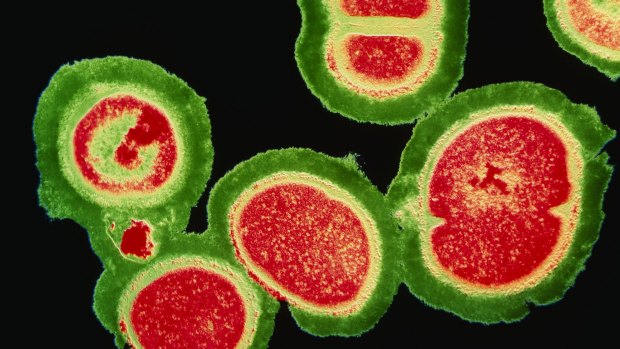 A deadly cluster of resistant staphylococcus bacteria.