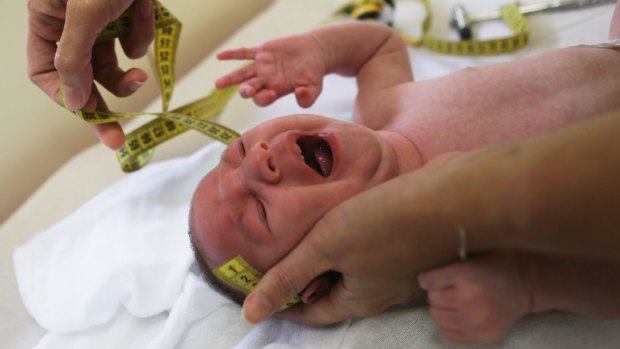 A doctor measures the head of a baby with microcephaly in Brazil. The baby's mother was diagnosed with the Zika virus during her pregnancy. 