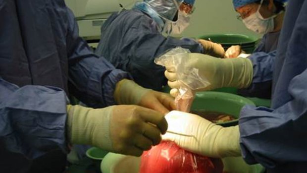 A medical team prepares a kidney for a transplant.