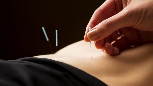 Acupuncture: part of the process.