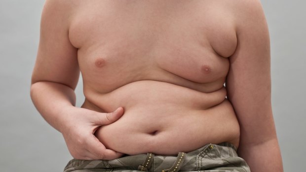 Childhood obesity: Who's to blame? 