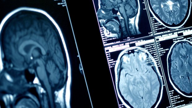 Researchers will test potential new drugs for the deadliest form of childhood brain cancer.