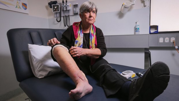 Sandra Hocking shows her healing superbug wound at the Austin Hospital. 