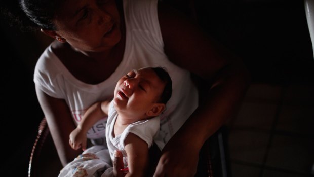 Alice Vitoria Gomes Bezerra, three-months-old, who has microcephaly, is held by her mother Nadja Cristina Gomes Bezerra in Recife, Brazil. 