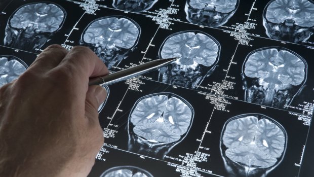 There is an emerging trend for neuroscience evidence to be brought to court to help the defence in criminal trials.