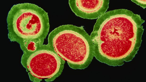 A deadly cluster of resistant staphylococcus bacteria.