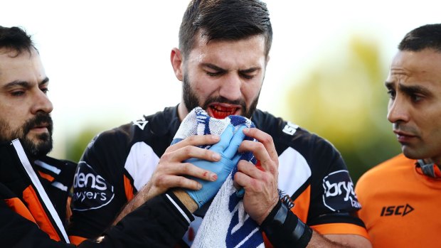 Sore one: James Tedesco leaves the field with a broken jaw.