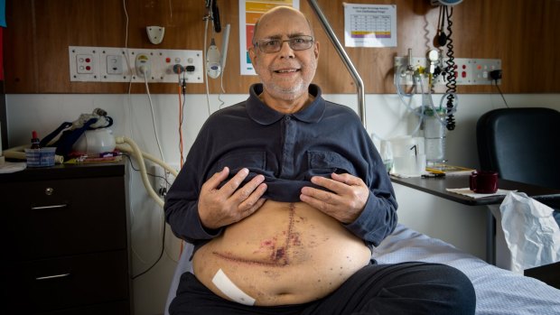 John Hatty had a liver transplant after suffering severe damage from fatty liver disease. 