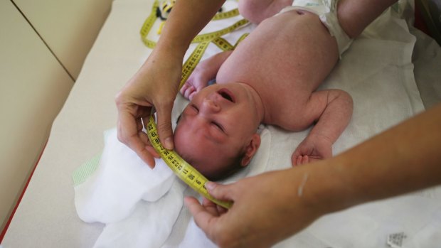 Dr Vanessa Van Der Linden, the neuro-pediatrician who first recognised the microcephaly crisis in Brazil, measures the head of a 2-month-old baby with microcephaly on January 27 in Recife, Brazil.  T