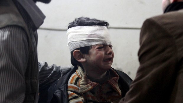 An child injured in an air strike by forces loyal to Syria's President  in Duma, Damascus.