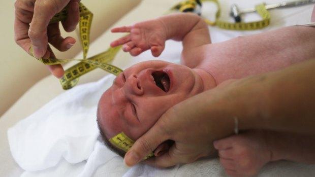 A doctor in Brazil measures the head of a two-month-old baby with microcephaly, which can be caused by Zika virus in the mother.