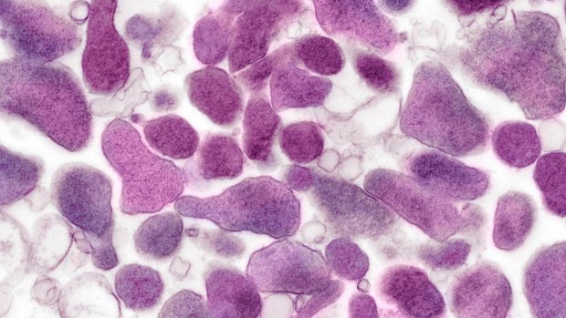 Mycoplasma genitalium could affect hundreds of thousands of Australians, but few know it exists.