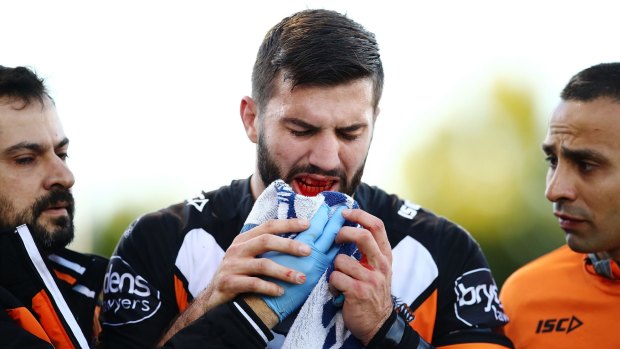 No bad blood: James Tedesco had four plates inserted in his jaw.