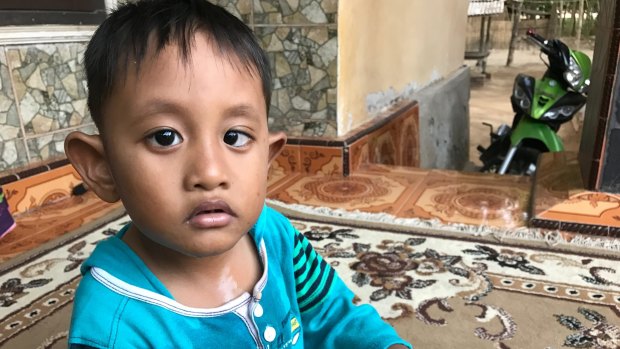 Rizki Ashadi, who is five, does not speak, and still wears a nappy.
