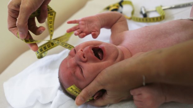 A doctor in Brazil measures the head of a two-month-old baby with microcephaly.