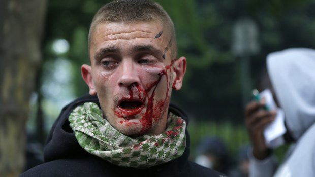 A wounded demonstrator in Paris on Tuesday.