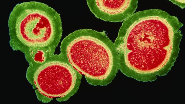 A deadly cluster of resistant staphylococcus bacteria.