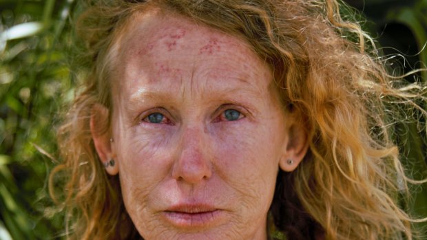Kerri Tonkin, one of the anti-CSG protesters who says she was pepper-sprayed by police.