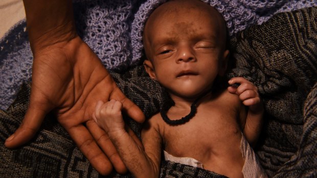 Ifran, a tiny malnourished baby, his heart struggling with every breath, lies on a stretcher in a Red Cross field hospital tent in south-eastern Bangladesh. 