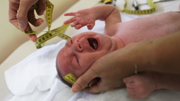 A doctor in Brazil measures the head of a two-month-old baby with microcephaly.