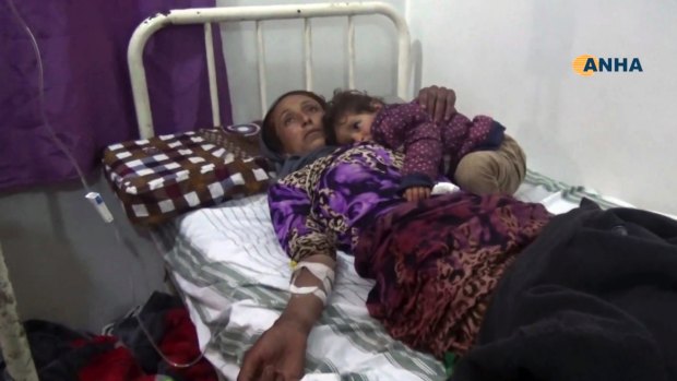 A woman wounded in an attack by IS in bed at a clinic in Hasakeh province, Syria.