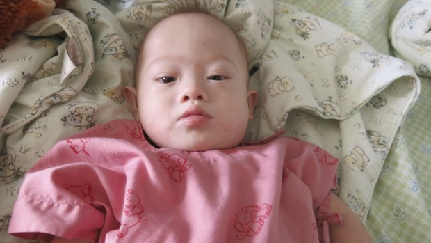Gammy, the baby born to a Thai surrogate mother to a West Australian couple.