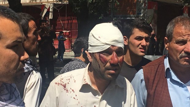 An injured man is seen after Wednesday's explosion explosion in Kabul, Afghanistan.
