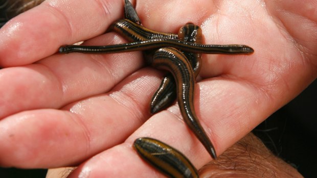 Be glad inhalers were invented: leeches used to be a popular way to treat asthma.
