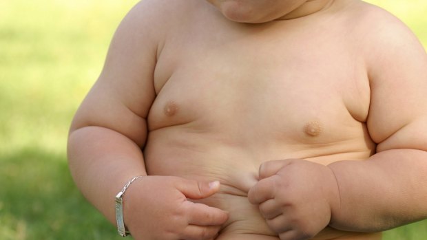 Preschoolers who are obese are two to three times more likely to end up in hospital than children who are a healthy weight or overweight, a study by Sydney University has found. 