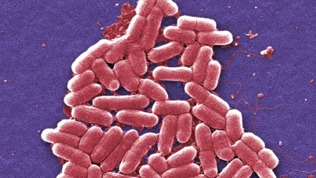 The strain of the E. coli bacteria. 