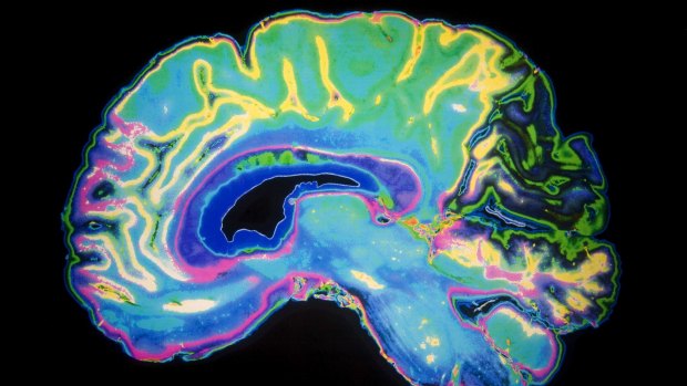 A magnetic resonance imaging scan of the human brain. 