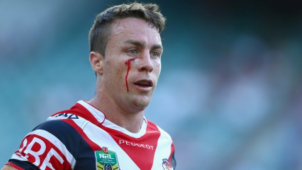 Bad day at the office: James Maloney was among the wounded against the Sharks.