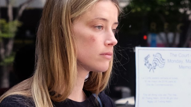A bruised Amber Heard leaves court after accusing husband Johnny Depp of domestic abuse.