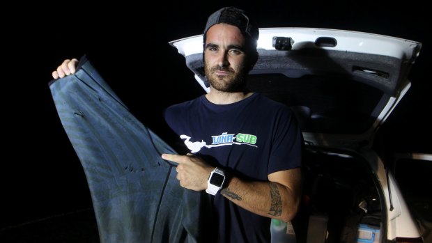 Gonzalo Mompo Fernandez shows the teeth marks on his wetsuit after he was bitten by a shark.