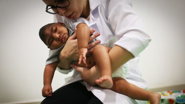 A Brazilian doctor performs physical therapy on an infant born with microcephaly, a birth defect linked to the Zika virus.