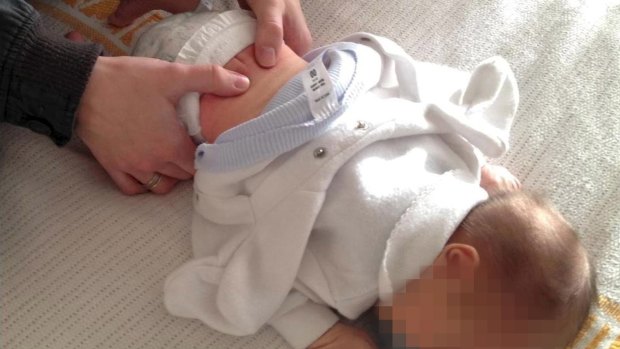 Some chiropractors are offering treatments to newborn babies. 