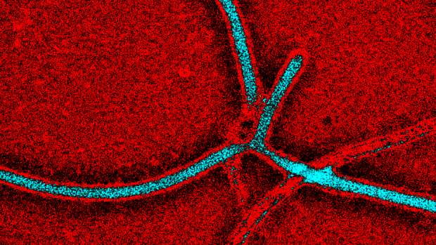 An artificially coloured electron micrograph image of Ebola Zaire.