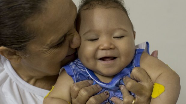 Caio Julio Vasconcelos, who was born with microcephaly, is kissed by a therapist at the Institute for the Blind in Joao Pessoa, Brazil, on Thursday.
