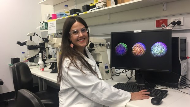 Clare Weeden from the Walter and Eliza Hall Institute team who believe they've discovered the "origin cell" of a common lung cancer.