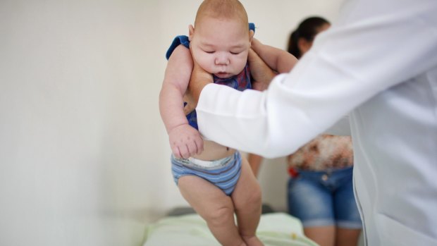 David Henrique Ferreira, five-months-old, who was born with microcephaly, is examined by a doctor on in Recife, Pernambuco state, Brazil. Ferreira's mother says she spends up to eight hours per day in transit on buses, three days per week, to visit a litany of doctors with David.