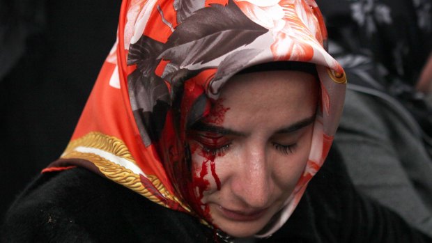 A woman bleeds from an injury after riot police dispersed supporters of the Zaman newspaper on Saturday.