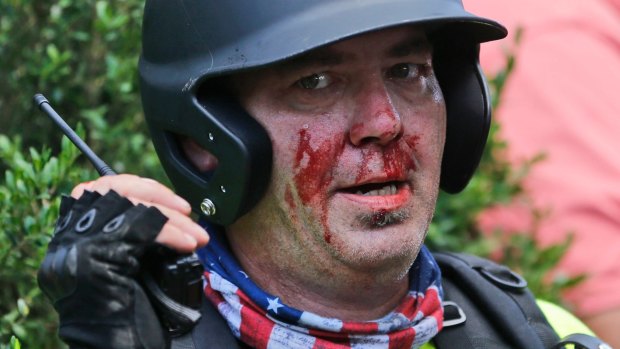 A white nationalist demonstrator left bloodied during the protest.