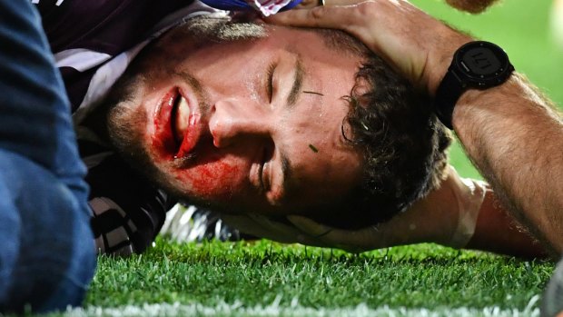 Horrible sight: Corey Oates is treated after the sickening head knock.