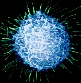 Image of a prostate cancer cell.