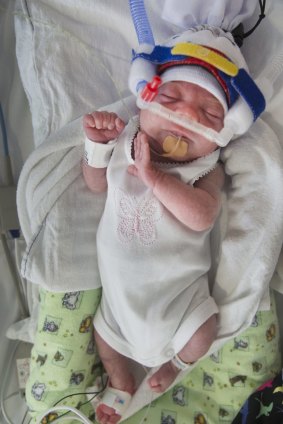 Baby Lexi weighed just 623 grams at birth.